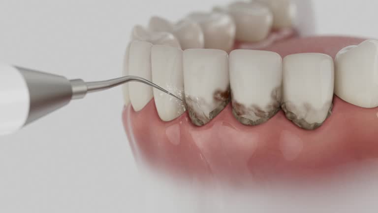 Reliable Dental contractor in Ridgeway, VA by Smile Center Dentistry